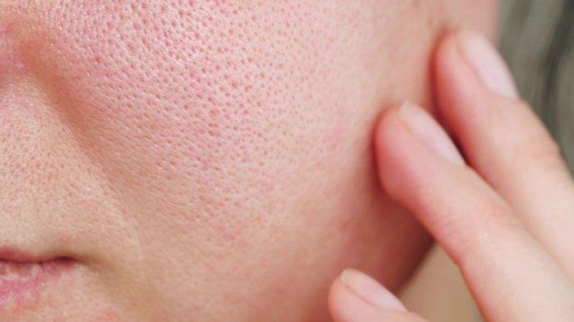 8 Racikan Masker Wajah dari Bahan Alami, Ampuh Mengecilkan Pori-pori di Kulit Wajah dengan Cepat