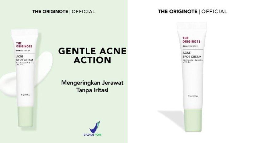 Review THE ORIGINOTE Acne Spot Cream, Obat Jerawat dengan Kandungan Calamine, Ampuh Lawan Jerawat