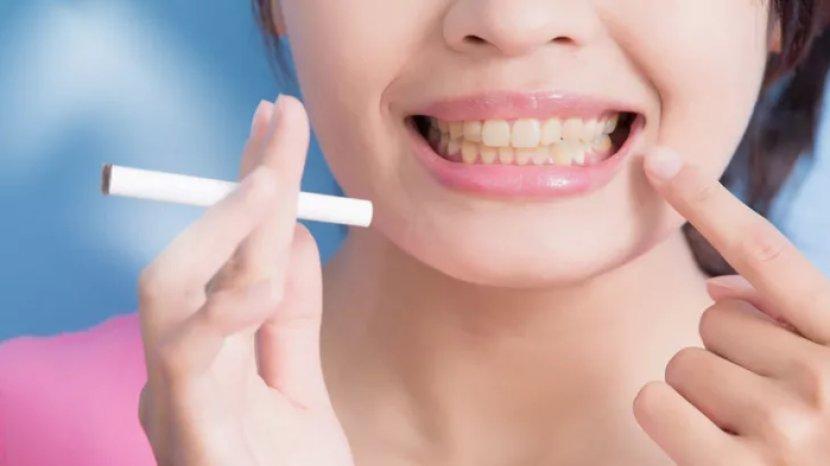 4 Tips Memutihkan Gigi yang Menguning Akibat Merokok, Mudah Dilakukan di Rumah
