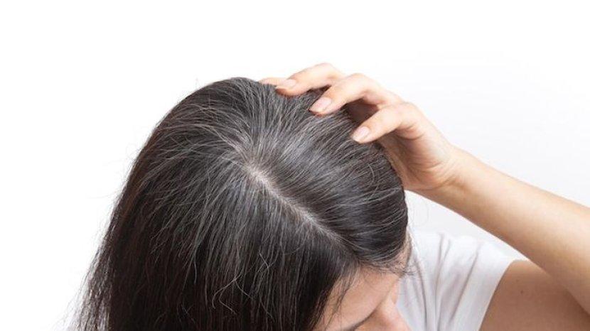 Umur Masih 30an tapi Uban Sudah Muncul? Atasi dengan 7 Bahan Alami Ini