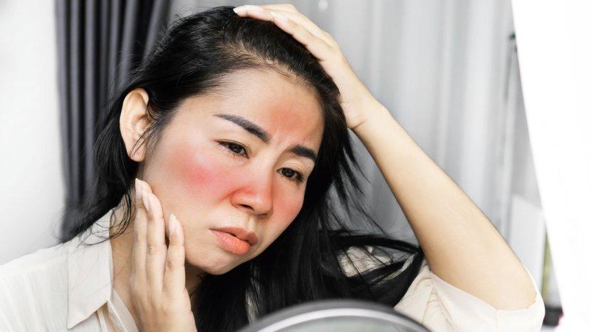 wajah-merah.jpg