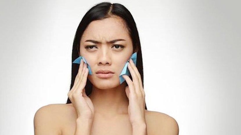 10 Makanan Penyebab Kulit Berminyak, Bukan Hanya Gula dan Gorengan Lho