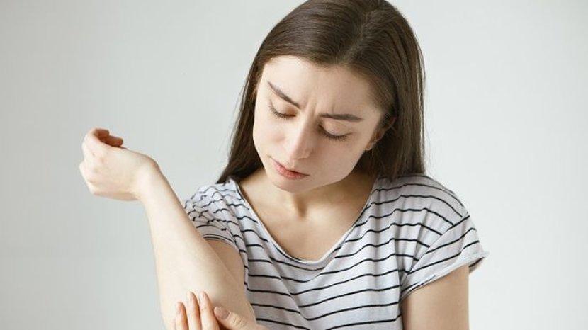 Rawat Kulit Eksim saat Cuaca Panas dan Terik dengan 5 Cara Ini