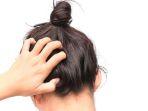 25 Daftar Shampoo Anti Ketombe yang Ampuh Bikin Kulit Kepala Bebas Gatal