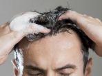 30 Daftar Shampoo Penghilang Ketombe untuk Kulit Kepala Ekstra Bersih