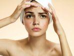 Jangan Dilakukan, Ini 11 Kebiasaan Buruk yang Bikin Jerawat Makin Parah