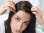 7 Tips Hilangkan Kutu Rambut dan Telurnya yang Membandel, Bersih Bebas Gatal dan Lepek