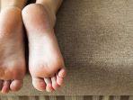 9 Penyebab Tumit Kaki Kering Merekah dan Pecah-pecah, Bukan Hanya Faktor Panas Musim Kemarau