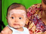 6 Rekomendasi Bedak Dingin Bayi yang Aman dan Dapat Membantu Menenangkan Kulit