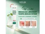 Review NPURE Cica Acne Spot Cream: Manfaat, Kelebihan hingga Kekurangan