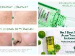 45 Rekomendasi Toner Khusus untuk Kulit Berjerawat yang Sudah BPOM, Cocok Jadi Andalan Acne Fighter