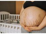 8 Cara Alami yang Ampuh Mengatasi Stretch Mark, Guratan di Kulit karena Kehamilan