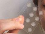 5 Rekomendasi Acne Patch yang Ampuh untuk Mengempiskan Jerawat