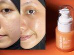 6 Rekomendasi Serum Retinol Terbaik yang Aman untuk Pemula