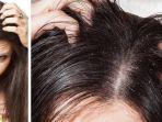 Tips Praktis Hilangkan Gatal pada Rambut, Kepala Sehat Anti Ketombe