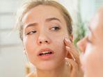 Kulitmu Kering? Ini 6 Kandungan Skincare Terbaik untuk Melembapkannya