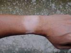 Kulit Belang Kembali Cerah dengan Perawatan Rutin Menggunakan 9 Bahan Alami Ini