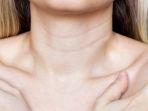 Mengatasi Keriput Leher tanpa Operasi, Ada 3 Treatment yang Bisa Dicoba