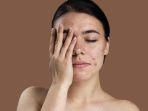 7 Tanda Skincare yang Kamu Gunakan Tidak Cocok untuk Kulitmu