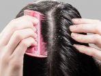 5 Penyebab Ketombe di Rambut Makin Parah
