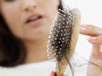 5 Pilihan Hair Serum untuk Merawat Rambut Rontok