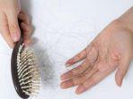 Rambutmu Rontok? Ini 5 Rekomendasi Sampo Khusus untuk Rambut Rontok