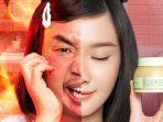 Review SOMETHINC Calm Down! Skinpair R-Cover Cream, Efektif Menenangkan 'Kulit Ngamuk'