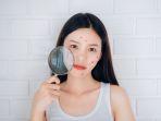 5 Rekomendasi Acne Patch Terbaik untuk Menyembuhkan Jerawat