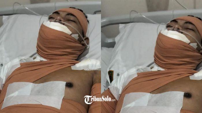 LUKA BAKAR - Seorang pegawai dapur SPPG Mojosongo mengalami kecelakaan kerja pada Senin (17/11/2025) dini hari. Korban harus menjalani perawatan intensif di rumah sakit setelah tersiram minyak panas dan mengalami luka bakar cukup serius.