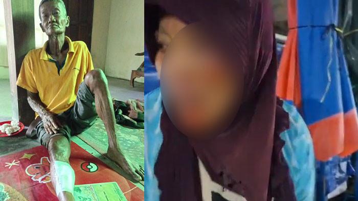 TERLUKA - Kondisi Lasmono (62) dan istrinya Painem (60), warga Dukuh Paingan, Desa Plumbon, Kecamatan Sambungmacan, Kabupaten Sragen alami luka-luka, Selasa (21/4/2026). Pasutri lansia ini mengalami luka-luka setelah terjatuh dari motor akibat terjerat kabel internet yang menjuntai rendah di depan Rumdin Bupati Sragen, Selasa (21/4/2026) malam.