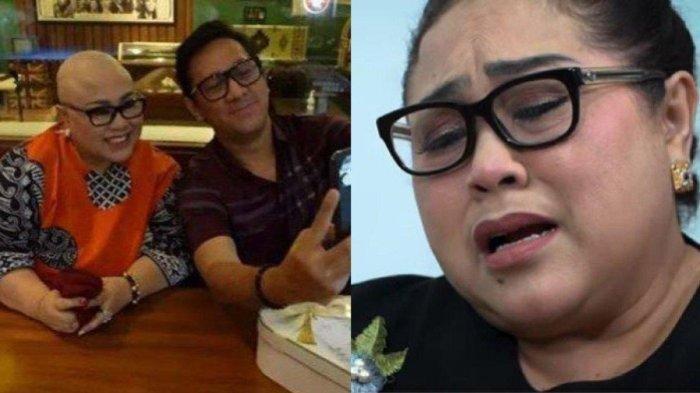 Kisah Nunung Botak Gara-gara Kemoterapi : Pekerja Salon Sampai Nangis saat Potong Rambut