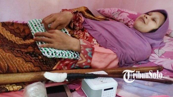 Kondisi Sulami, Manusia Kayu Asal Sragen Sebelum Meninggal, Setelah Lebaran Kesehatan Memburuk