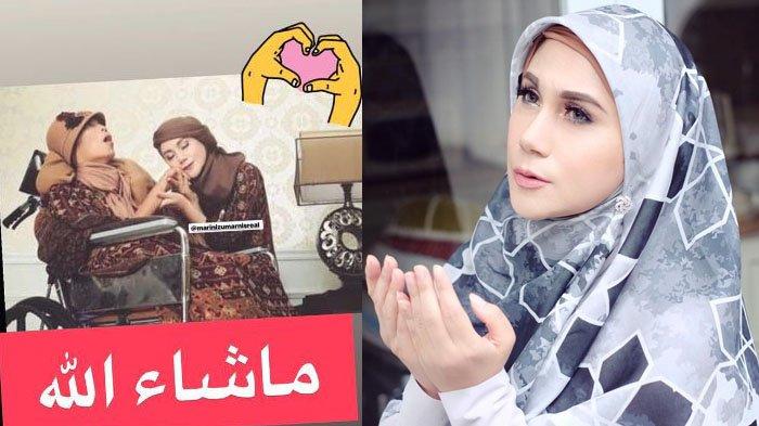Kenali Aneurisma, Penyakit 'Bom Waktu' yang Renggut Nyawa Ibunda Marini Zumarnis