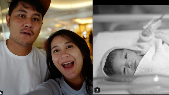 Pecah Pembuluh Darah Saat Melahirkan, Wajah Ryana Dea Berubah Menjadi Begini