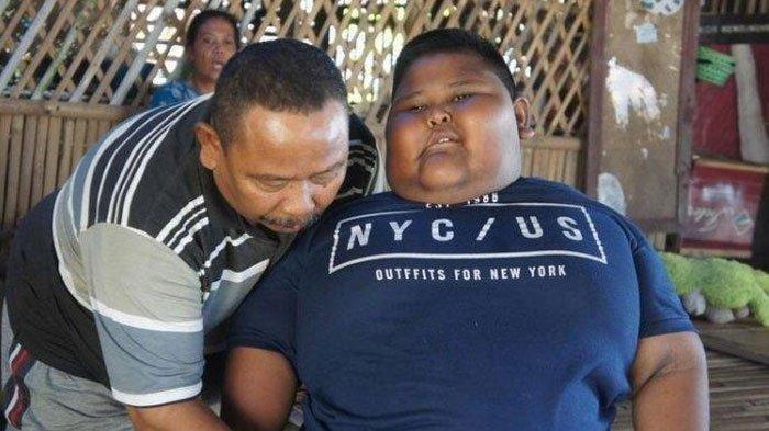 Anak 7 Tahun di Karawang Derita Obesitas: Makan 7 Kali, Tak Bisa Tidur & Berharap Bantuan Pemerintah