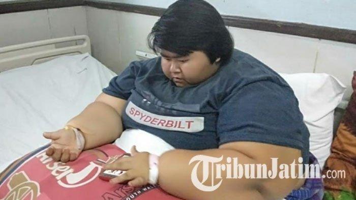 Gadis Penderita Obesitas dengan Berat Badan 142 Kilogram di Sidoarjo Meninggal Dunia