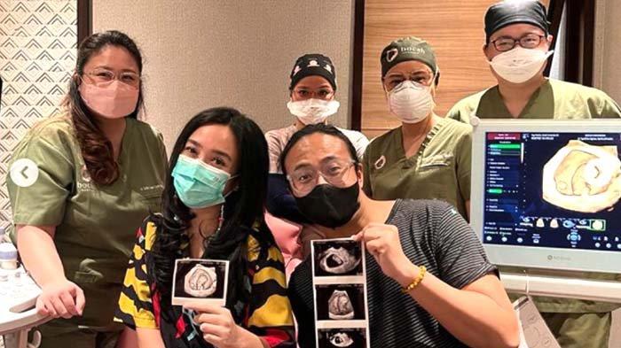Dea Ananda Umumkan Kehamilan Anak Pertama Usai Penantian 12 Tahun Pernikahan, Ungkap Perjuangannya