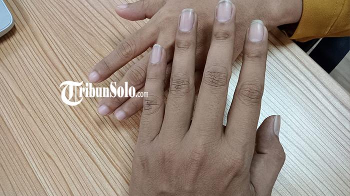 Di Balik Peningkatan Temuan Kasus Kekerasan Seksual di Kampus Solo, Kesadaran Korban Melapor Naik