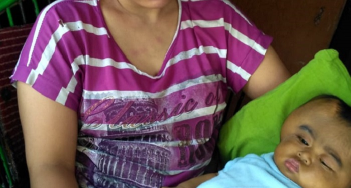 Seorang Bayi di Baki Sukoharjo Mengidap Dua Penyakit Ganas, Butuh Biaya Rp 2 Miliar untuk Operasi