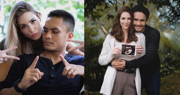 Randy Pangalila Bagikan Kabar Bahagia, Istri Bulenya Hamil Anak Pertama