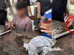 RING-BESI-NYANGKUT-Proses-evakuasi-ring-besi-yang-tersangkut-di-jari-Radit-9.jpg