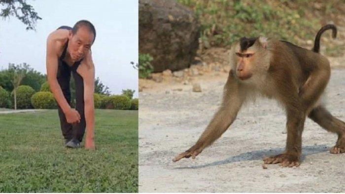 TEKA-TEKI Pria Ini Gelantungan Seperti Monyet Selama 30 Tahun Terungkap, Ternyata Ini Alasannya