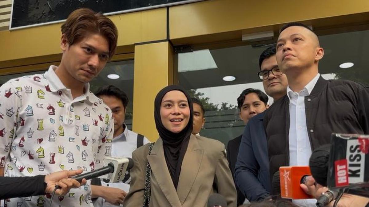 Di tengah kasus dugaan pelanggaran hak cipta yang dilaporkan Yoni Dores, penyanyi dangdut Lesti Kejora justru menunjukkan sikap tenang.