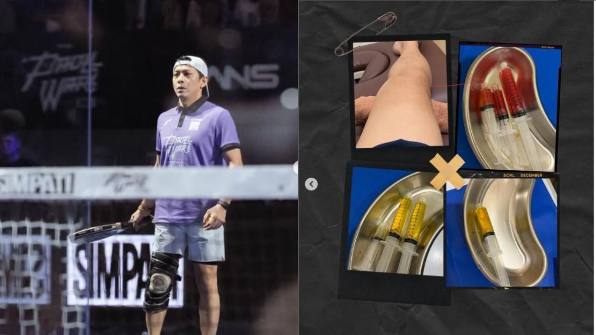 Ariel NOAH mengungkap bahwa ia didiagnosis meniscus tear complex, robekan pada meniskus, bantalan sendi lutut yang berfungsi sebagai peredam kejut.