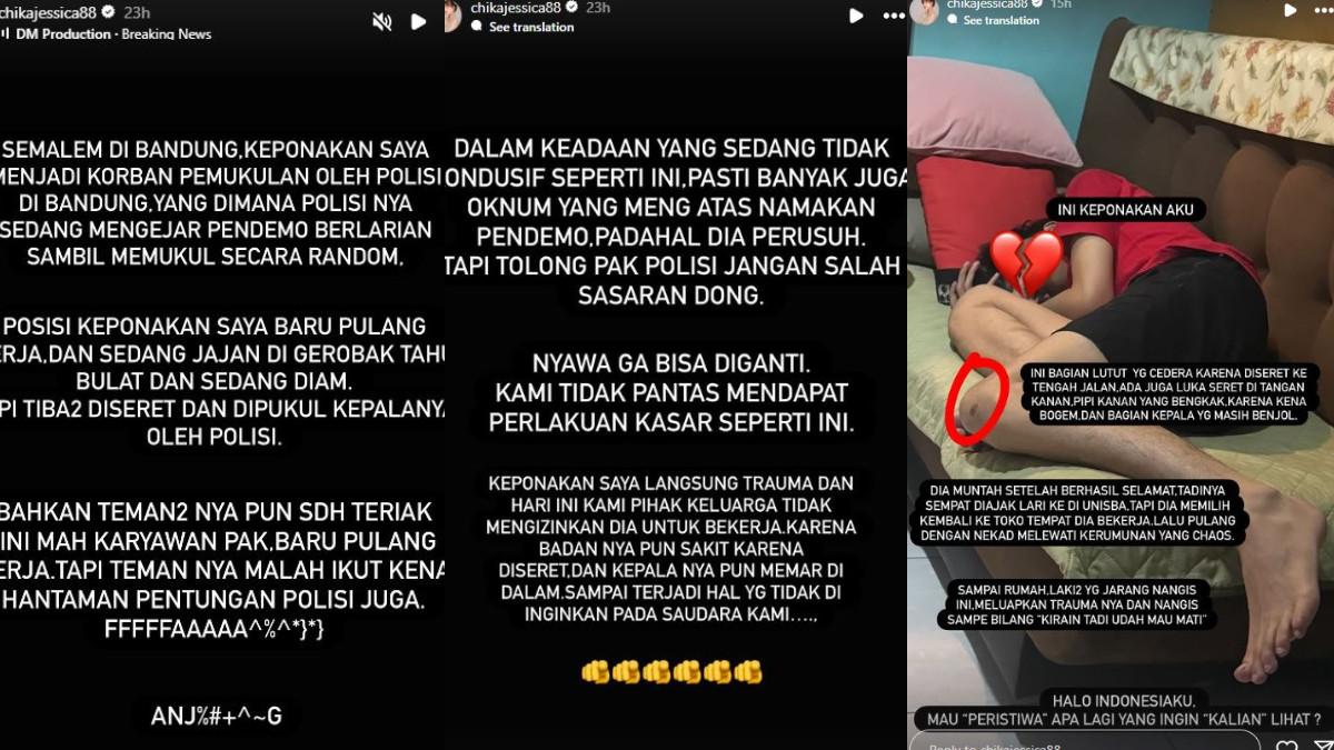 Chika Jessica bagikan kondisi terkini keponakannya setelah jadi korban salah pukul oleh aparat saat demo.