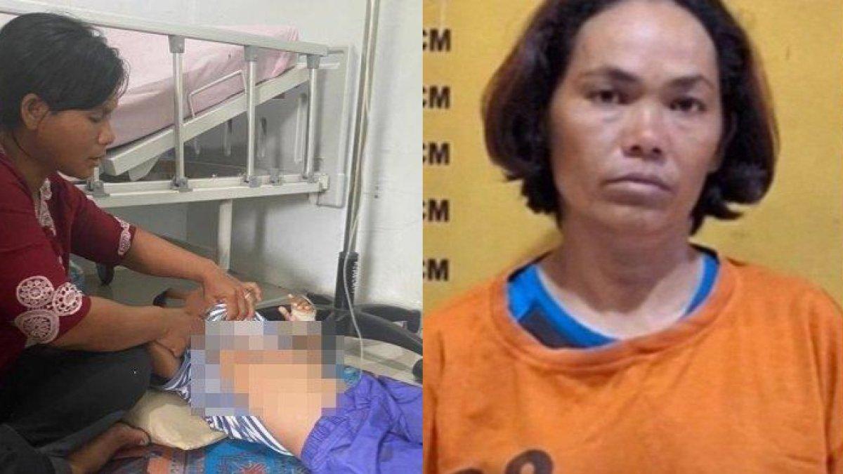 TAMPANG SM, Tante yang Tega Setrika Perut Bocah Yatim di Sumut, Emosi Gara-gara Habiskan Rambutan