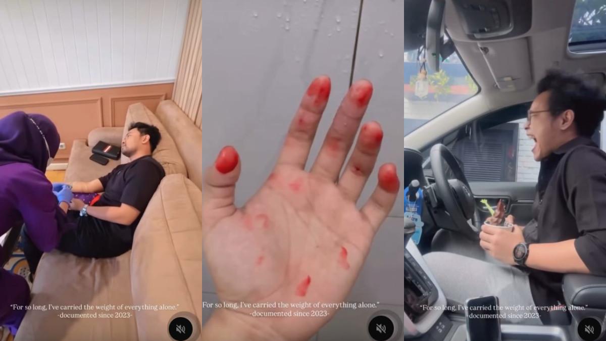 Insanul Fahmi curhat kerasnya hidup, bagikan foto tangan berdarah hingga teriak di dalam mobil seolah sedang stres,