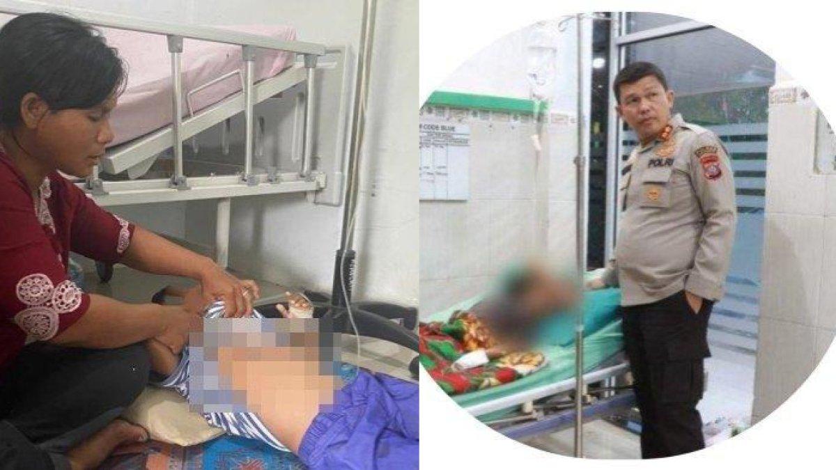 KISAH Pilu Anak Yatim di Sumatera Dianiaya Tantenya dengan Setrika Panas Gara-gara Habiskan Rambutan