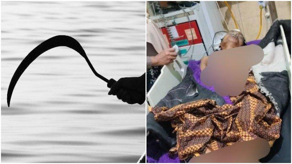 NAHAS Nasib Pria di Probolinggo, Niatnya Menolong Malah Diacungi Celurit, Melawan Jarinya Putus