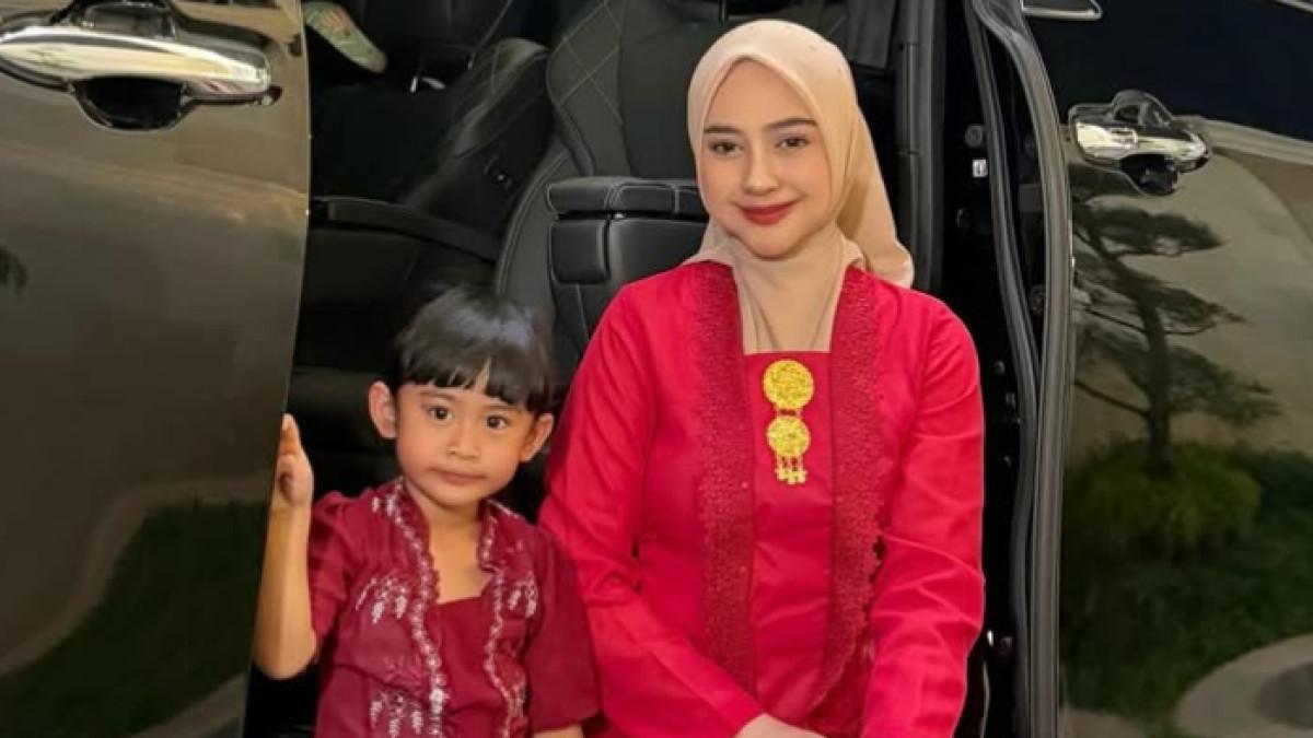 RIA RICIS OPLAS - Ria Ricis lakukan operasi plastik di bagian hidung. Adik Oki Setiana Dewi beber reaksi sang anak.